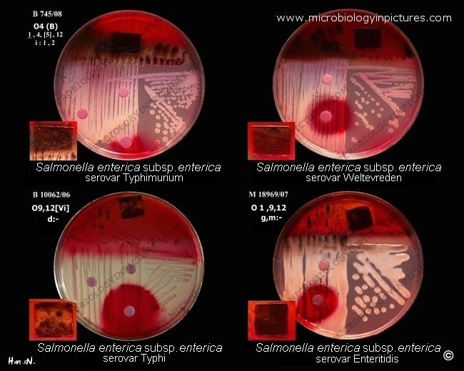 salmonella enterica serovars (serotypes)